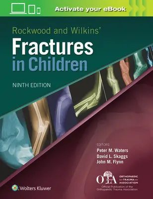 Rockwood und Wilkins Frakturen bei Kindern - Rockwood and Wilkins Fractures in Children