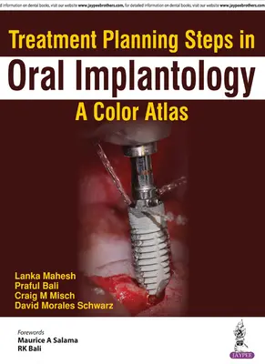 Schritte der Behandlungsplanung in der oralen Implantologie: Ein Farbatlas - Treatment Planning Steps in Oral Implantology: A Color Atlas