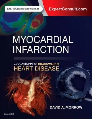 Myokardinfarkt: A Companion to Braunwald's Heart Disease - Myocardial Infarction: A Companion to Braunwald's Heart Disease