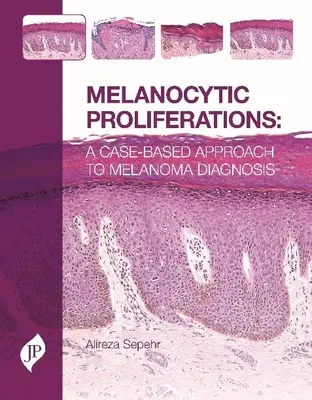 Melanozytäre Proliferationen - Ein fallbasierter Ansatz zur Melanomdiagnose - Melanocytic Proliferations - A Case-Based Approach to Melanoma Diagnosis