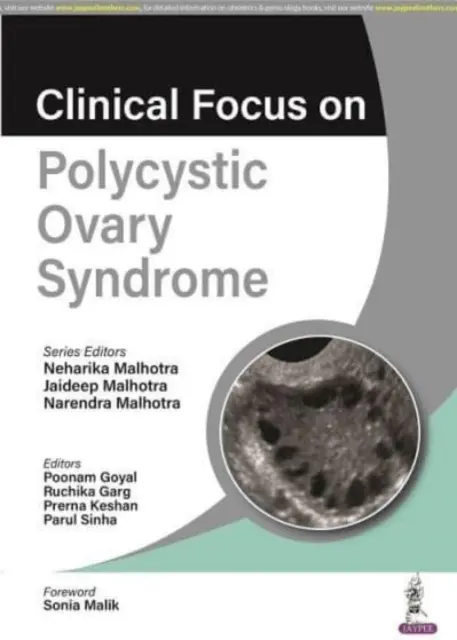 Klinischer Schwerpunkt: Polyzystisches Ovarsyndrom - Clinical Focus on Polycystic Ovary Syndrome