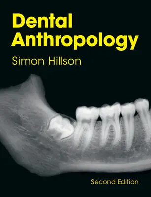 Zahnärztliche Anthropologie (Hillson Simon (University College London)) - Dental Anthropology (Hillson Simon (University College London))