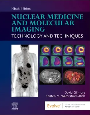 Nuklearmedizin und molekulare Bildgebung: Technologie und Techniken - Nuclear Medicine and Molecular Imaging: Technology and Techniques