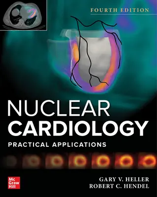 Nuklearkardiologie: Praktische Anwendungen, Vierte Auflage - Nuclear Cardiology: Practical Applications, Fourth Edition