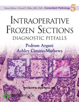 Intraoperative Gefrierschnitte: Diagnostische Fallstricke - Intraoperative Frozen Sections: Diagnostic Pitfalls