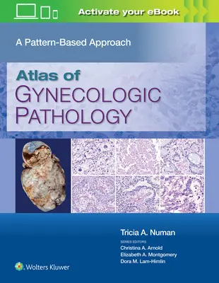 Atlas der gynäkologischen Pathologie: Ein musterbasierter Ansatz - Atlas of Gynecologic Pathology: A Pattern-Based Approach