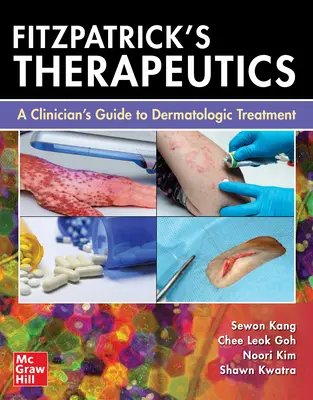 Fitzpatrick's Therapeutics: Ein Leitfaden für Kliniker zur dermatologischen Behandlung - Fitzpatrick's Therapeutics: A Clinician's Guide to Dermatologic Treatment