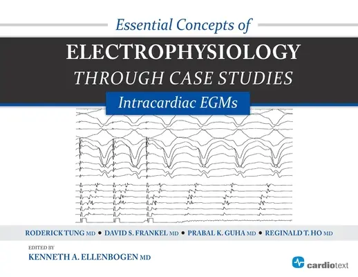 Grundlegende Konzepte der Elektrophysiologie anhand von Fallstudien: Intrakardiale EGMs: Intrakardiale EGMs - Essential Concepts of Electrophysiology Through Case Studies: Intracardiac EGMs: Intracardiac EGMs