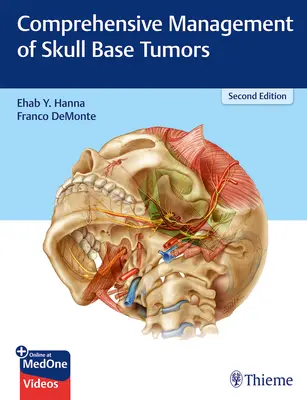 Umfassendes Management von Schädelbasistumoren - Comprehensive Management of Skull Base Tumors