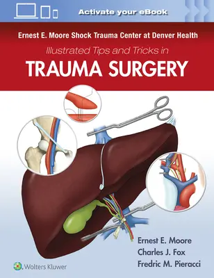 Ernest E. Moore Shock Trauma Center at Denver Health Illustrierte Tipps und Tricks in der Traumachirurgie - Ernest E. Moore Shock Trauma Center at Denver Health Illustrated Tips and Tricks in Trauma Surgery