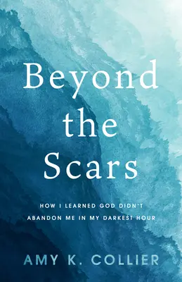 Jenseits der Narben: Wie ich lernte, dass Gott mich in meiner dunkelsten Stunde nicht im Stich gelassen hat - Beyond the Scars: How I Learned God Didn't Abandon Me in My Darkest Hour