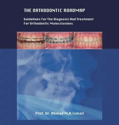 Der kieferorthopädische Fahrplan: Leitlinien für die Diagnose und Behandlung von kieferorthopädischen Fehlstellungen - The Orthodontic Roadmap: Guidelines for the Diagnosis and Treatment of Orthodontic Malocclusions
