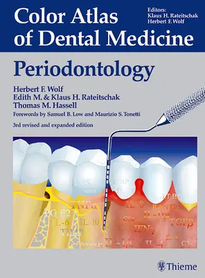 Farbatlas der Zahnmedizin: Parodontologie - Color Atlas of Dental Medicine: Periodontology