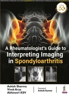 Leitfaden für Rheumatologen zur Interpretation von Bildgebung bei Spondyloarthritis - Rheumatologist's Guide to Interpreting Imaging in Spondyloarthritis