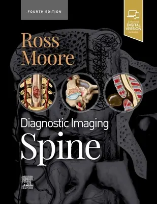 Diagnostische Bildgebung: Wirbelsäule (Ross Jeffrey S. (Professor für Radiologie Mayo Clinic College Rochester Minnesota)) - Diagnostic Imaging: Spine (Ross Jeffrey S. (Professor of Radiology Mayo Clinic College Rochester Minnesota))