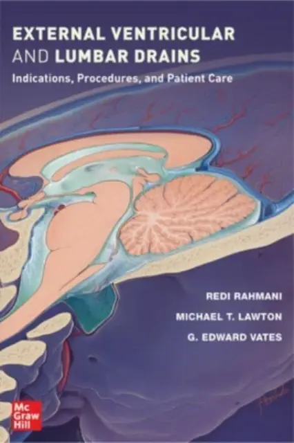 Externe ventrikuläre und lumbale Drainagen: Indikationen, Verfahren und Patientenversorgung - External Ventricular and Lumbar Drains: Indications, Procedures, and Patient Care