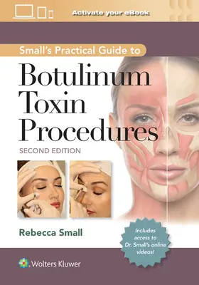 Kleiner praktischer Leitfaden für Botulinumtoxin-Verfahren - Small's Practical Guide to Botulinum Toxin Procedures