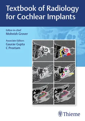 Lehrbuch der Radiologie für Cochlea-Implantate - Textbook of Radiology for Cochlear Implants