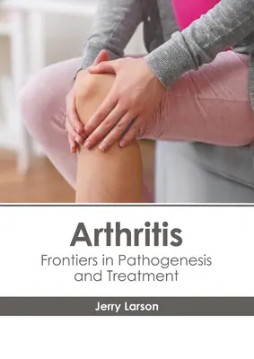 Arthritis: Frontiers in Pathogenese und Behandlung - Arthritis: Frontiers in Pathogenesis and Treatment