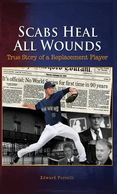 Schorf heilt alle Wunden: Die wahre Geschichte eines Ersatzspielers - Scabs Heal All Wounds: True Story of a Replacement Player