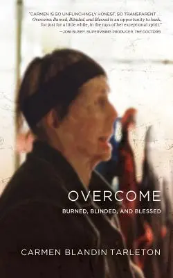 Überwunden: Verbrannt, geblendet und gesegnet - Overcome: Burned, Blinded, and Blessed