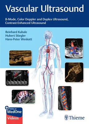 Gefäß-Ultraschall: B-Mode, Farbdoppler und Duplex-Ultraschall, kontrastverstärkter Ultraschall - Vascular Ultrasound: B-Mode, Color Doppler and Duplex Ultrasound, Contrast-Enhanced Ultrasound