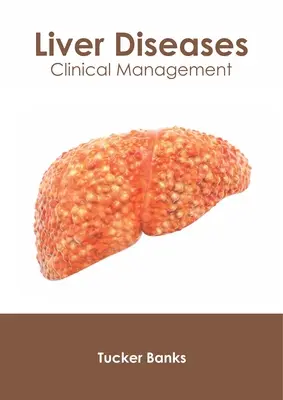 Leberkrankheiten: Klinisches Management - Liver Diseases: Clinical Management