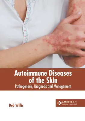 Autoimmunkrankheiten der Haut: Pathogenese, Diagnose und Management - Autoimmune Diseases of the Skin: Pathogenesis, Diagnosis and Management