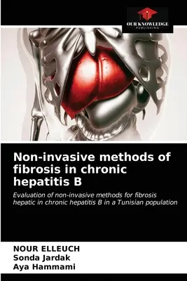 Nicht-invasive Methoden der Fibrosebestimmung bei chronischer Hepatitis B - Non-invasive methods of fibrosis in chronic hepatitis B