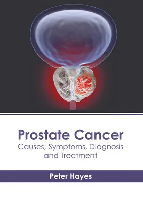 Prostatakrebs: Ursachen, Symptome, Diagnose und Behandlung - Prostate Cancer: Causes, Symptoms, Diagnosis and Treatment