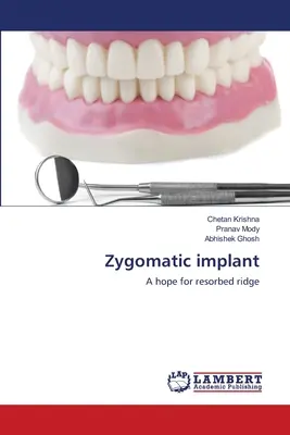 Jochbein-Implantat - Zygomatic implant