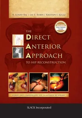 Der direkte anteriore Zugang zur Hüftrekonstruktion - The Direct Anterior Approach to Hip Reconstruction