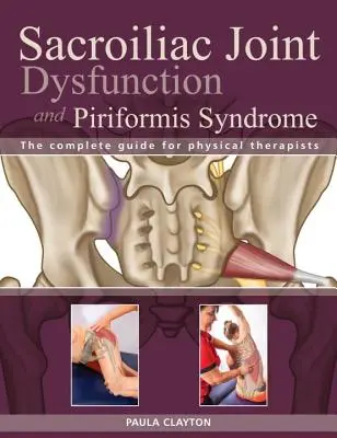 Iliosakralgelenk-Dysfunktion und Piriformis-Syndrom: Der vollständige Leitfaden für Physiotherapeuten - Sacroiliac Joint Dysfunction and Piriformis Syndrome: The Complete Guide for Physical Therapists