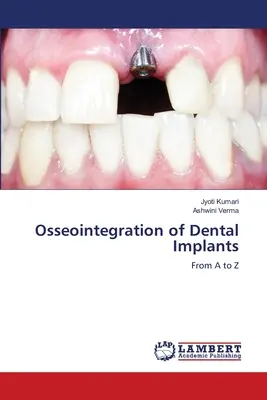 Osseointegration von Zahnimplantaten - Osseointegration of Dental Implants