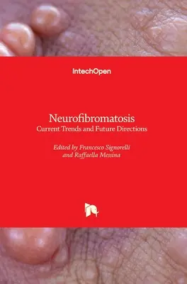 Neurofibromatose: Aktuelle Trends und zukünftige Wege - Neurofibromatosis: Current Trends and Future Directions