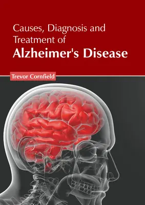Ursachen, Diagnose und Behandlung der Alzheimer-Krankheit - Causes, Diagnosis and Treatment of Alzheimer's Disease