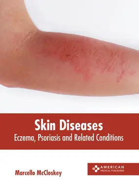 Hautkrankheiten: Ekzem, Schuppenflechte und verwandte Erkrankungen - Skin Diseases: Eczema, Psoriasis and Related Conditions
