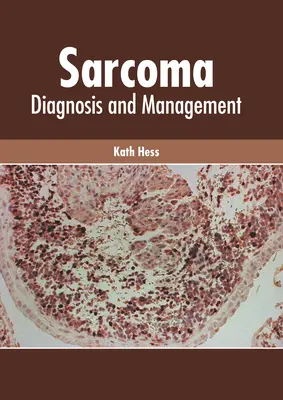 Sarkom: Diagnose und Management - Sarcoma: Diagnosis and Management