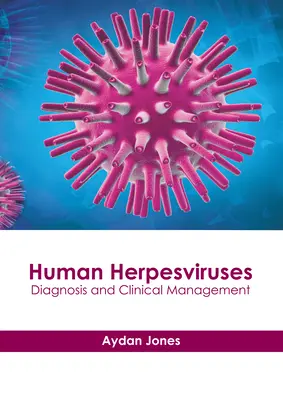 Humane Herpesviren: Diagnose und klinisches Management - Human Herpesviruses: Diagnosis and Clinical Management