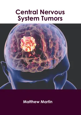 Tumore des Zentralnervensystems - Central Nervous System Tumors