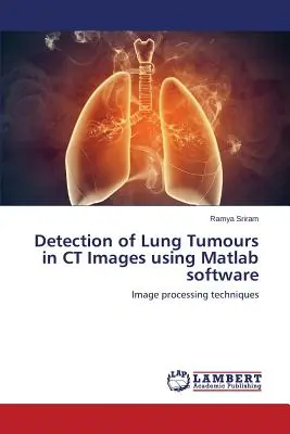 Erkennung von Lungentumoren in CT-Bildern mit Matlab-Software - Detection of Lung Tumours in CT Images using Matlab software
