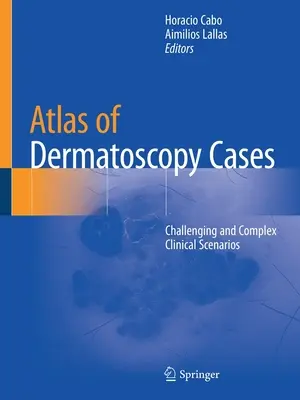 Atlas der Dermatoskopie-Fälle: Anspruchsvolle und komplexe klinische Szenarien - Atlas of Dermatoscopy Cases: Challenging and Complex Clinical Scenarios