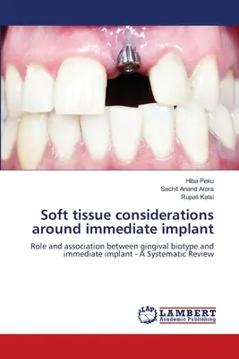 Überlegungen zum Weichgewebe um das Sofortimplantat - Soft tissue considerations around immediate implant