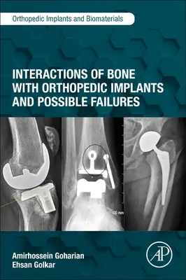 Wechselwirkungen von Knochen mit orthopädischen Implantaten und mögliche Fehler - Interactions of Bone with Orthopedic Implants and Possible Failures