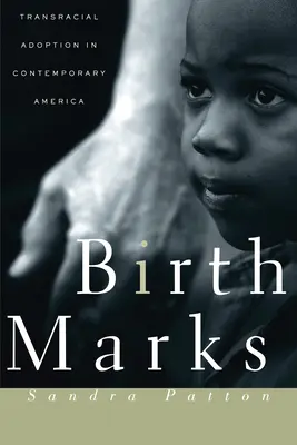 Muttermale: Transrassische Adoption im heutigen Amerika - Birthmarks: Transracial Adoption in Contemporary America