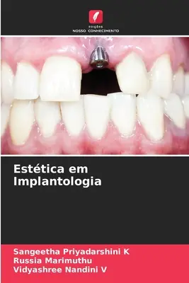 Esttica em Implantologia