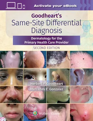 Goodheart's Same-Site Differential Diagnosis: Dermatologie für den primären Gesundheitsdienstleister - Goodheart's Same-Site Differential Diagnosis: Dermatology for the Primary Health Care Provider