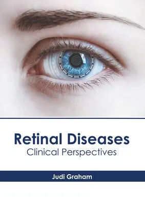 Netzhautkrankheiten: Klinische Perspektiven - Retinal Diseases: Clinical Perspectives