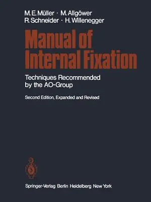 Handbuch der internen Fixierung: Von der Ao-Gruppe empfohlene Techniken - Manual of Internal Fixation: Techniques Recommended by the Ao Group