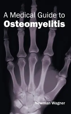 Medizinischer Leitfaden zur Osteomyelitis - Medical Guide to Osteomyelitis